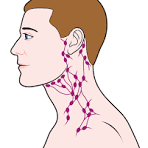 Head & Neck Cancer
